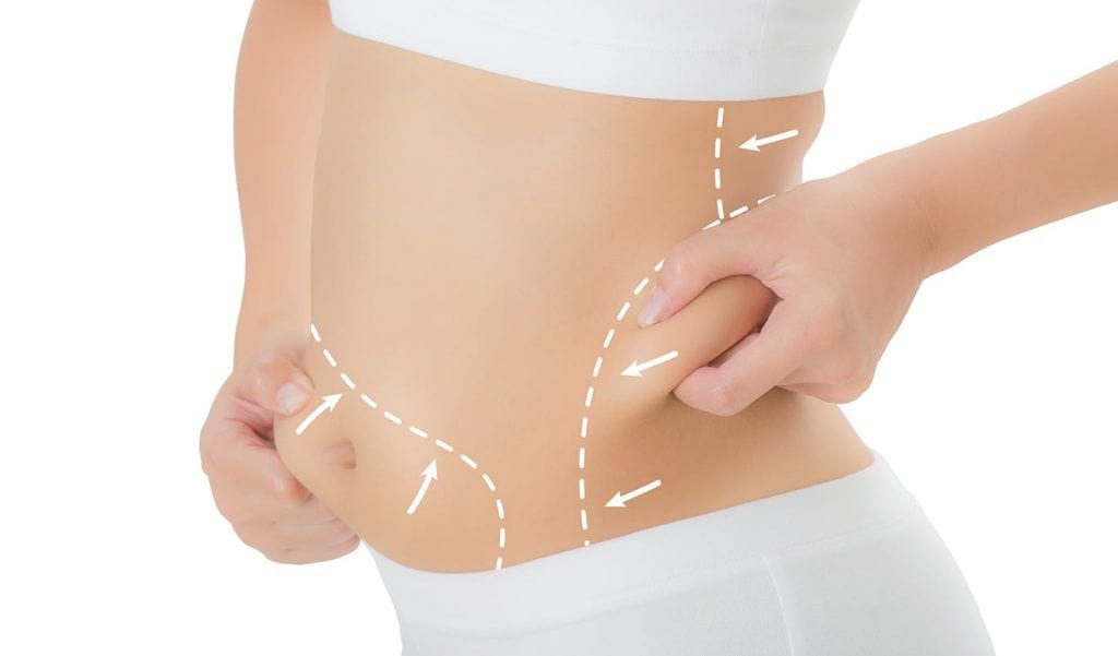 Non Surgical Fat Removal From Stomach