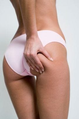 Cellulite reduction woman