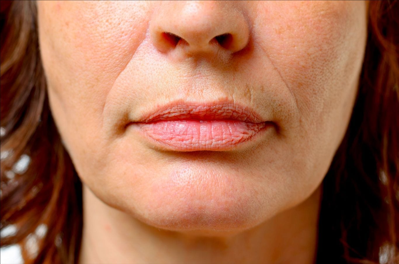 sagging-jowls-how-to-get-rid-of-jowls-dr-haus-dermatology