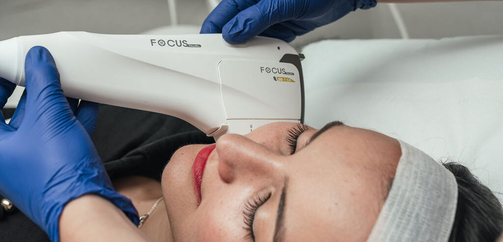 Radiofrequency Skin Tightening & Microneedling with Focus Dual