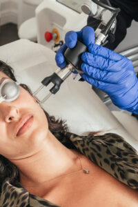 Red Touch Laser treatment being performed at Dr Haus Dermatology on Harley Street.